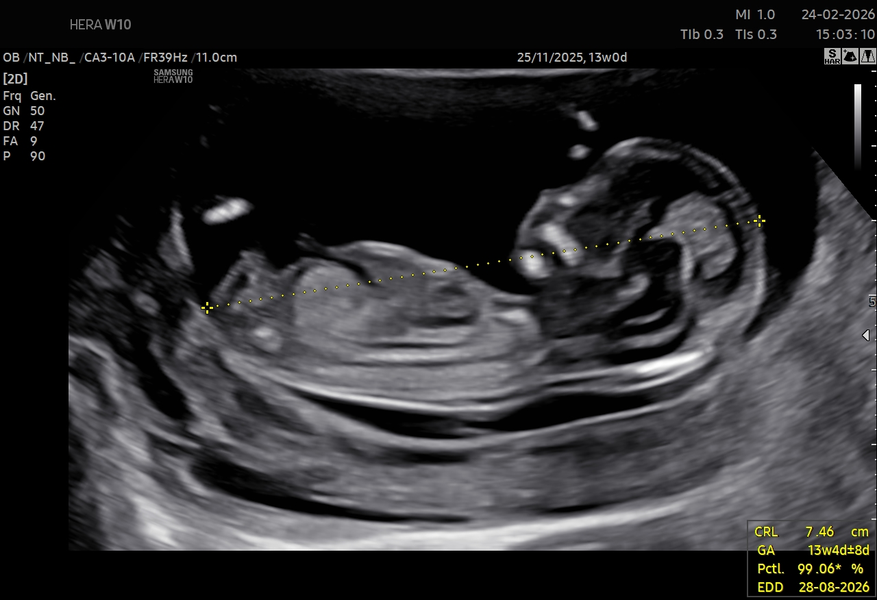 NT Scan