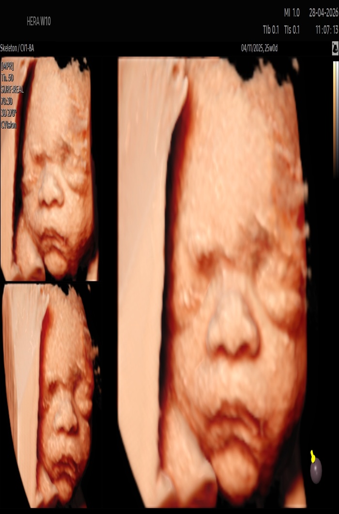 Anomaly Scan