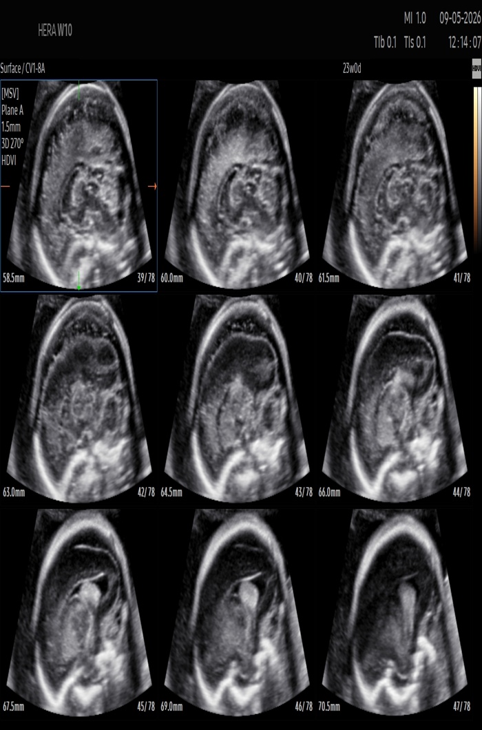 NT Scan Hands