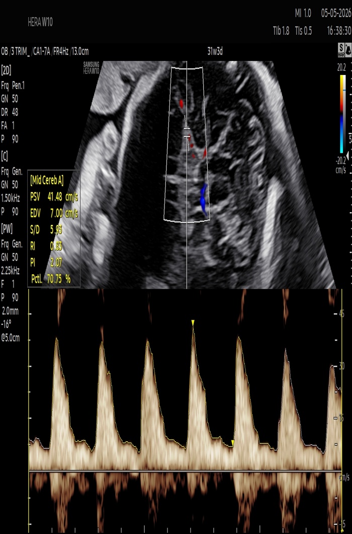 NT Scan Hands