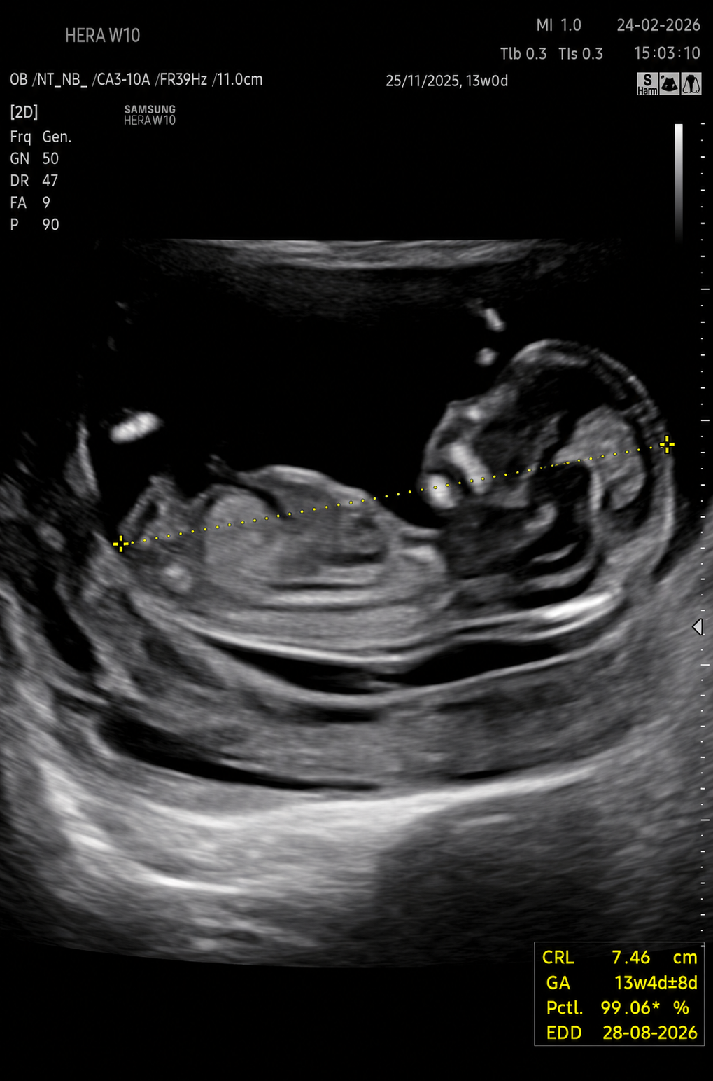 NT Scan Hands